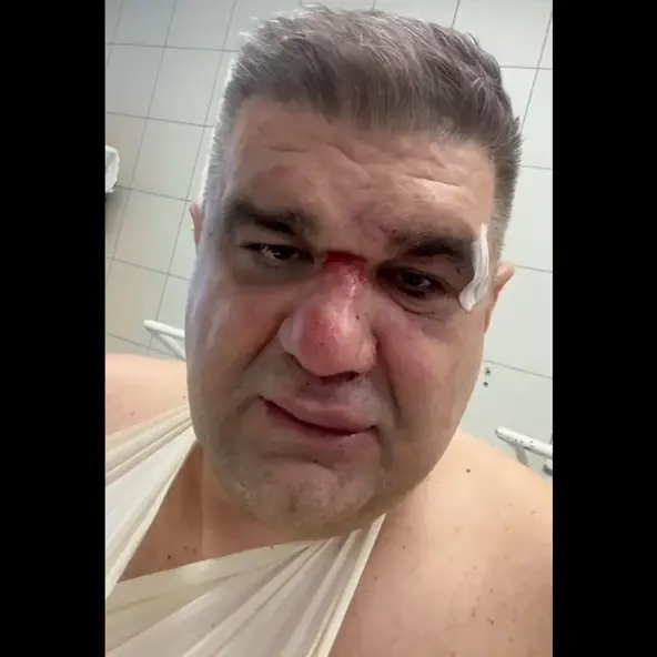 Saša Mirković javio se iz bolnice nakon tučnjave sa Veliborom Popovićem
